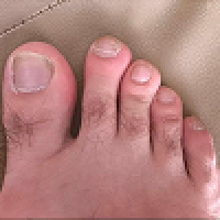 Array image